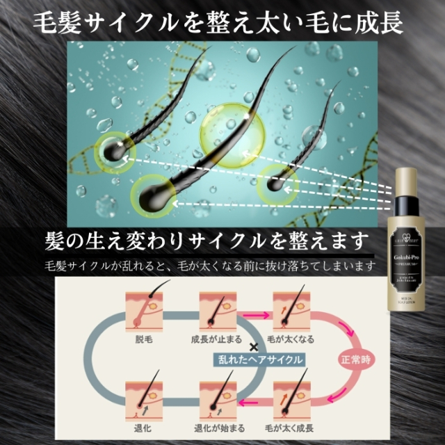 ゴクビプロメディカルスカルプローション